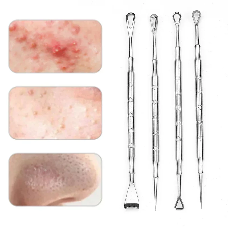 Ferramenta De Popper De Espinha Removedor De Cravos, remoção De Agulha De Acne, Tratamento Whitehead Popping Zit, Extrator De Blemish De Nariz Rosto