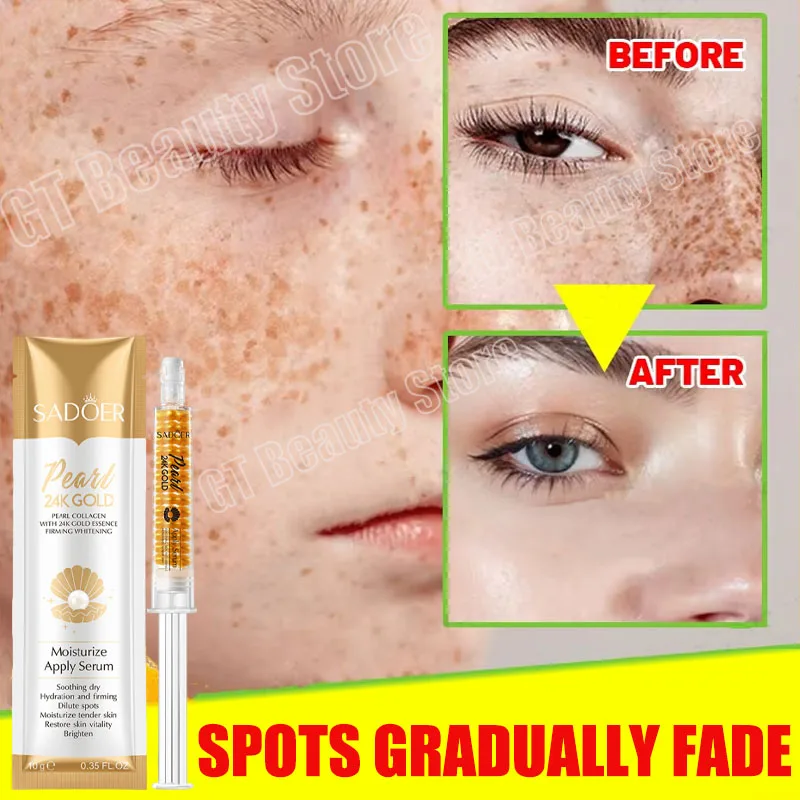 

Freckle Whitening Serum Cream Black Spots Melasma Remover Lighten Pigmentation Brightening Anti Pigment Skin Care Korean Product