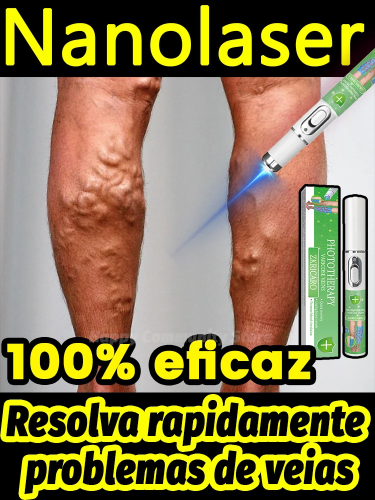 Hot sale Nano Laser Leg Vein