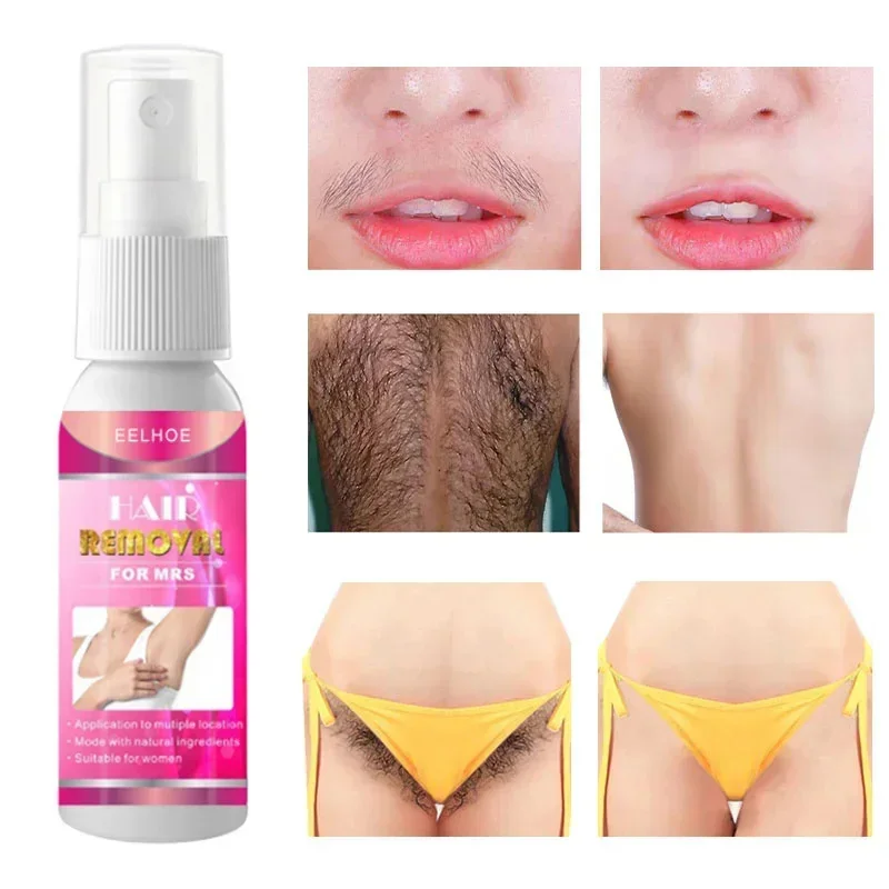 Fast Painless Hair Removal Spray Permanent Hair Growth Inhibitor Armpit Leg Arms Hair Remover Depilatory Norish Body Care Cream