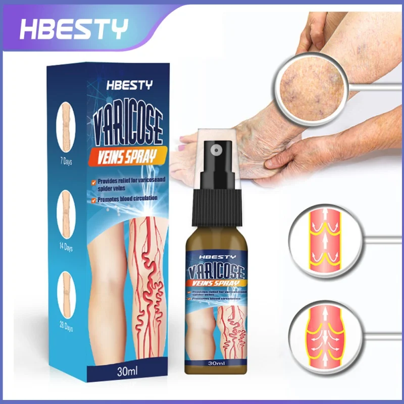 

HBESTY Spider blood vessels varicose veins spray leg soreness swelling vein relieve vasculitis phlebitis pain Treatment