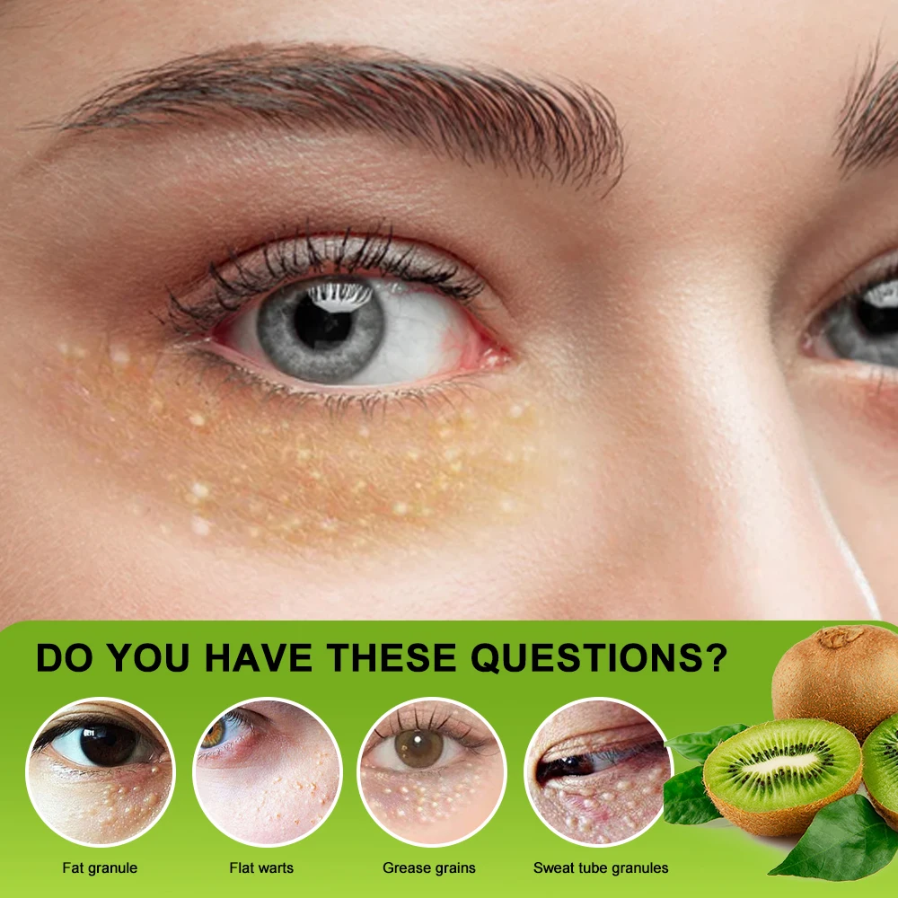 1/2/3pcs Fat Granules Remover Ointment Remove Subcutaneous Lumps Herbal Cream Fade Dark Circles Eyes Health Care Medical Plaster image 3