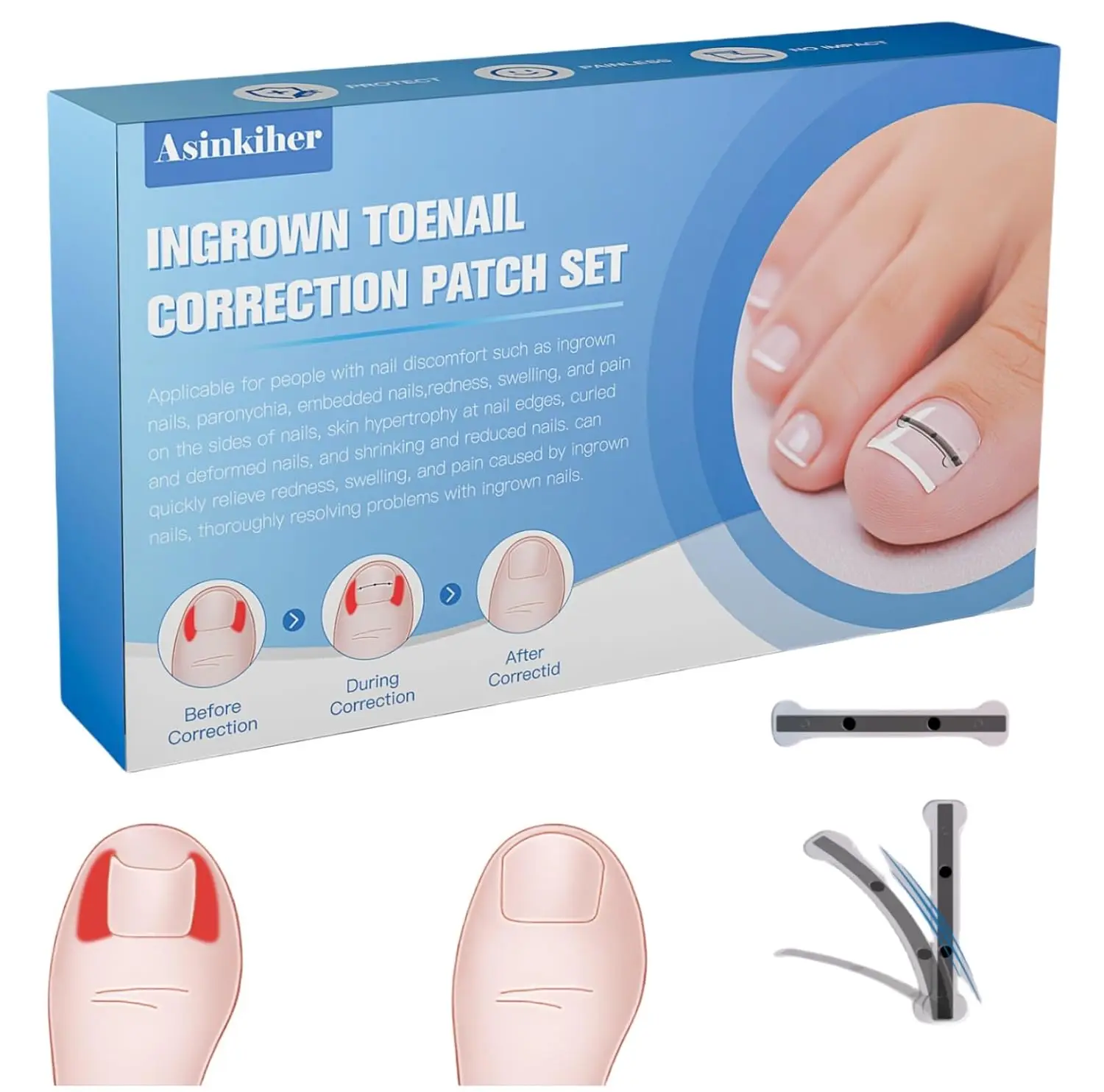 

Ingrown Toenail Correction Tool with Titanium Alloy, Flexible Sizes for Home Use