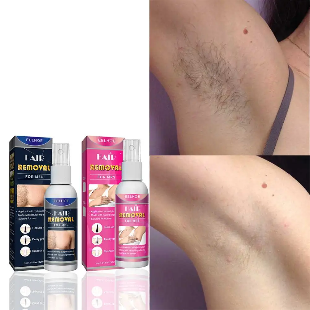 30ml Men's Hair Removal Spray Mild Non Irritating Quick Leg Hair Hair Products Hair Of Armpit Removal Hair Removal R0x7