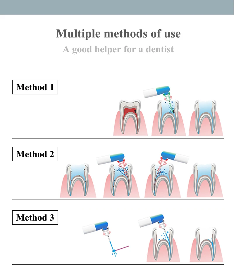 VVDental Endodontischer Wurzelkanal-Schall-Irrigator-Aktivator mit LED und 60 Stück Spitzen für die endodontische Reinigung – Zahnärztliches Instrument – Detail 6
