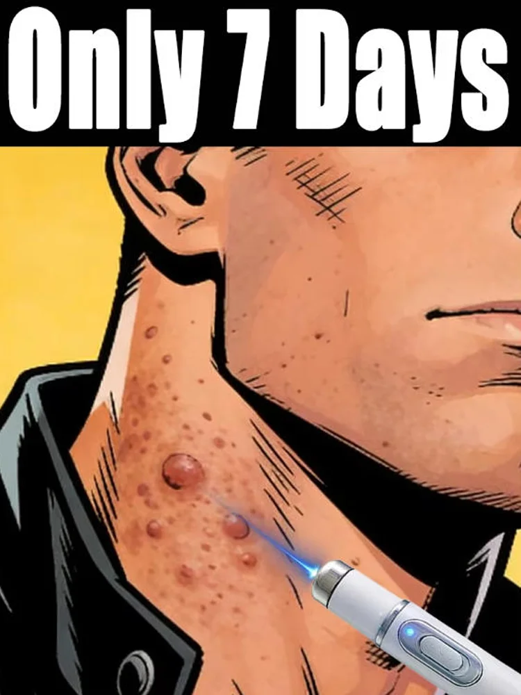 2026 ht Warts Blue Light Tool, Easy To Clean Skin Care Tool