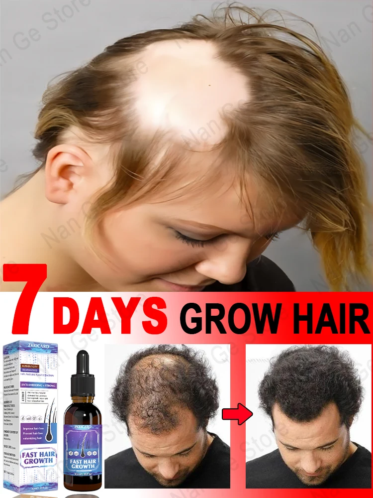 99% repurchase, more and more hair, say goodbye to baldness, hot selling product