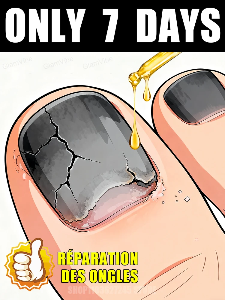 

ᑫᵘⁱᶜᵏ ᵀʳᵉᵃᵗᵐᵉⁿᵗ⸴ ᔆᵃʸ ᴳᵒᵒᵈᵇʸᵉ ᵗᵒ ᶠᵘⁿᵍᵃˡ ᴺᵃⁱˡ ᵂᵒʳʳⁱᵉˢHot-selling nail cleaning brush