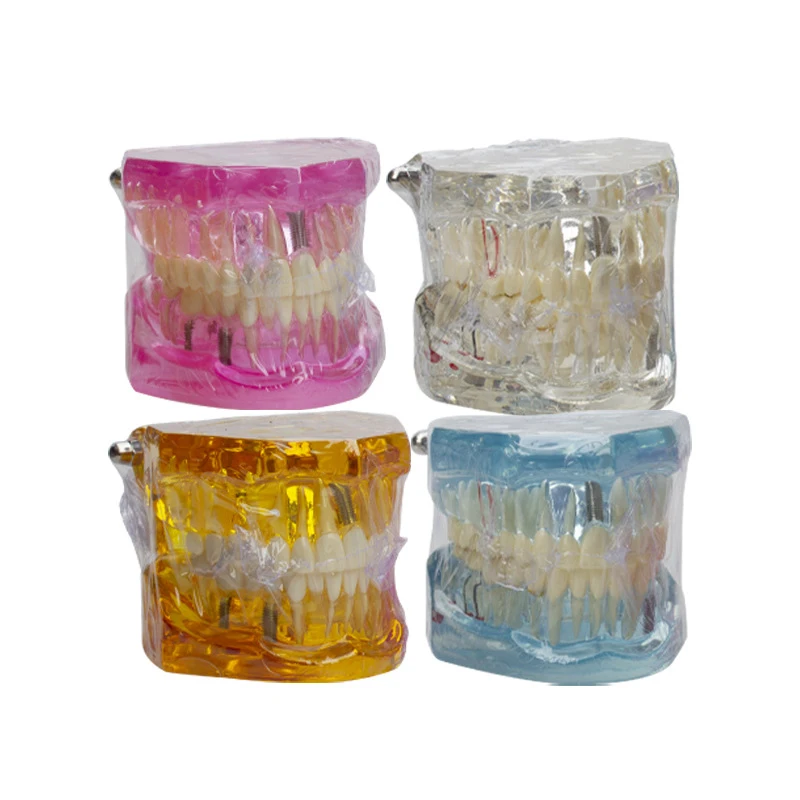 

Стандартная модель зубных зубов, съемные зубы с патологией, демонстрационное обучение, заболевание, демонстрационная модель стоматолога, стоматологические инструменты