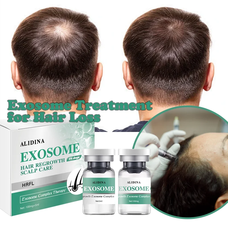 ZS EGF مكافحة تساقط الشعر إعادة نمو بصيلات الشعر إصلاح المغذيات Exosomes مجموعة العناية بفروة الرأس الجذعية نمو الخلايا عامل إعادة نمو الشعر السريع