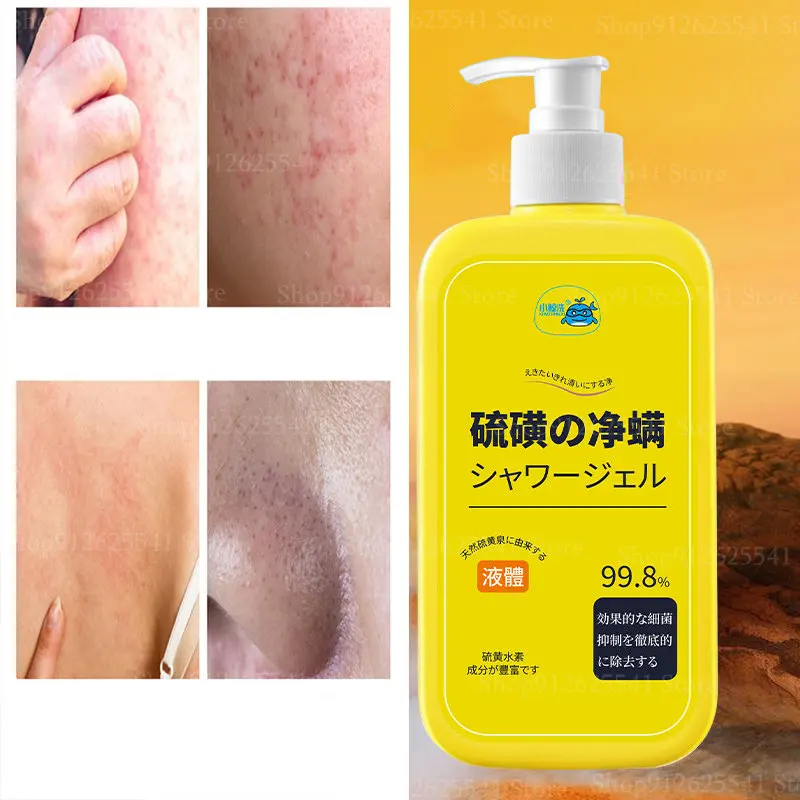 300ml Sulfur Anti-mite Liquid Soap Lasting Itching Oil Control Acne Moisturizing Net Mite Antibacterial Cleaning Wash Shower Gel