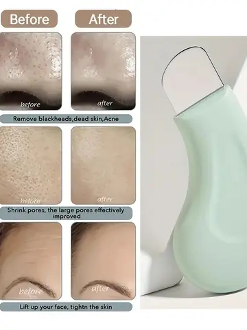 Blackhead and Whitehead Removal Tool for Nose and Face - Skin Pore Cleaner Skin Care Tools for Women
