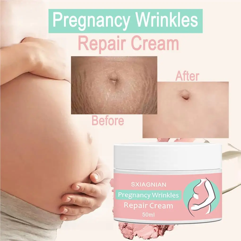 Women Stretch Mark Cream Pregnancy Wrinkles Comfortable Beauty Tools Safe Scars Remover Home Waist Body Care Supplies