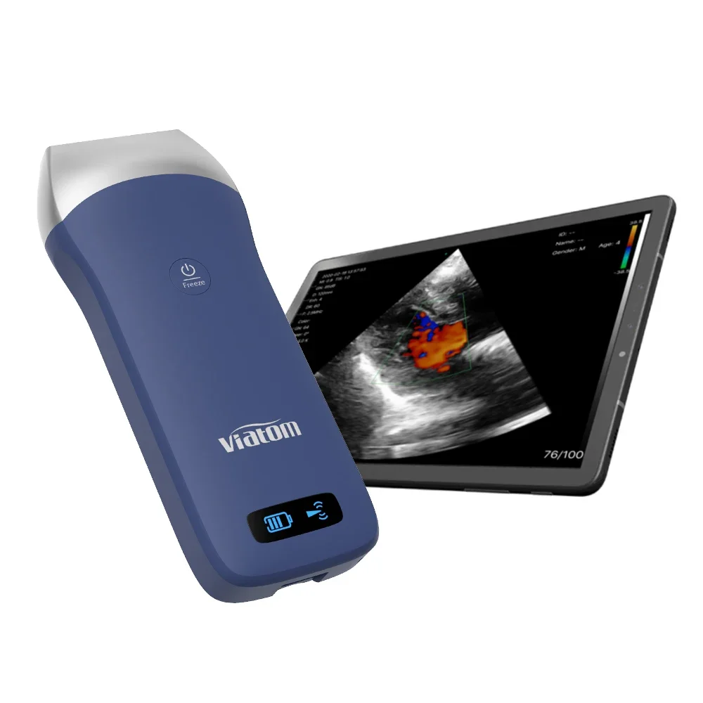 Viatom Wireless Ultrasound Linear 250 Gram Handheld Ultrasound Portable Ultrasound Scanner