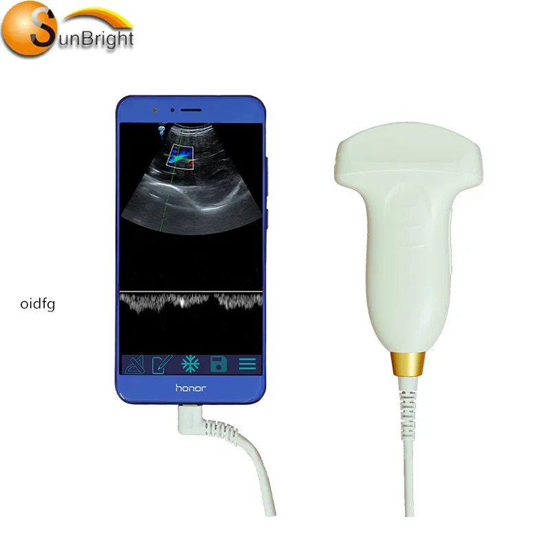 

world wide lightweight USB color doppler ultrasound convex probe