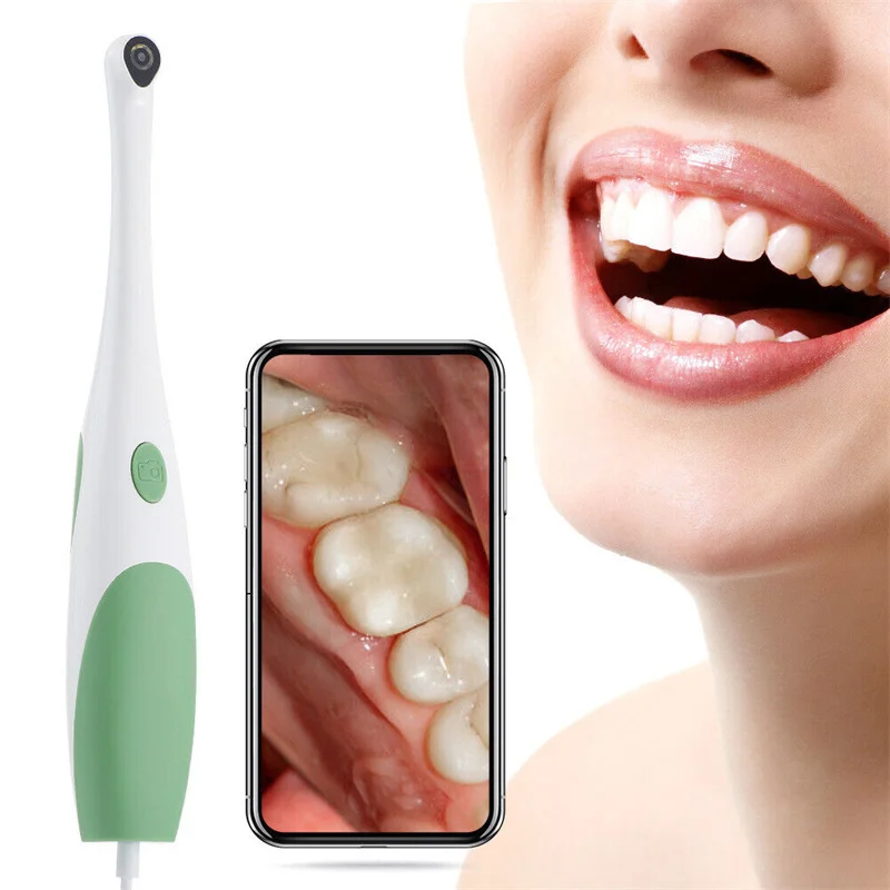 Dental Camera HD 480/1080P Intraoral Camera Visual Dental Instruments USB Capture Available with support Android PC Tablet