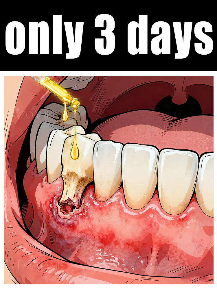 

Eᴀsɪʟʏ ʀᴇɢᴇɴᴇʀᴀᴛᴇ ɢᴜᴍs ᴀɴᴅ ᴄᴏᴠᴇʀ ᴛᴇᴇᴛʜ ɪɴ 7 ᴅᴀʏs