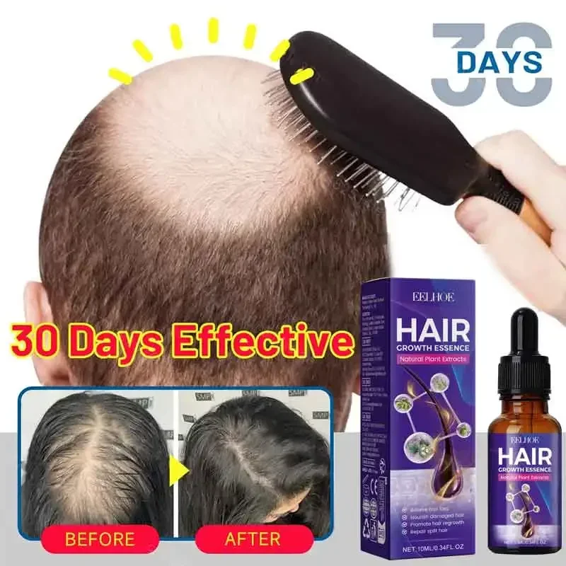 

99% of buyers buy again, have more and more hair, say goodbye to baldness, thick hair,Hot selling product