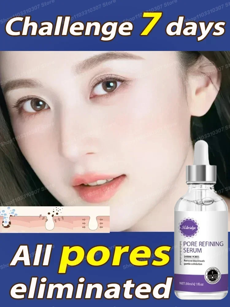 Pores  Closed  Smooth Face