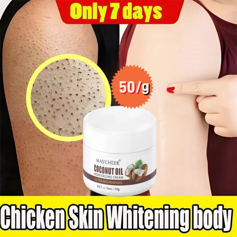 50g Chicken Skin Repair Cream Curing Keratosis Follicle Pilaris Remove Dead Skin Pore Spot Dull Whitening Moisturizer Body Care