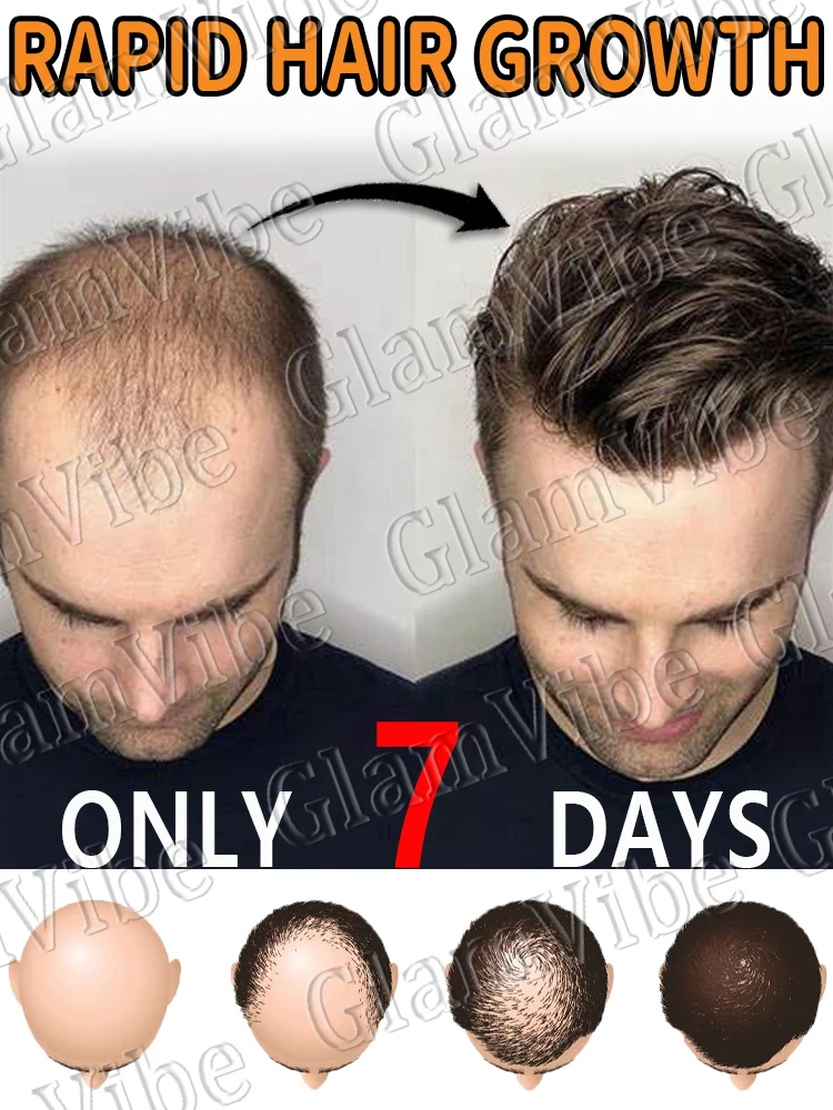 

Равно питает кожу головы, пополняет питательные вещества к корням волос и переразивает густым волос.