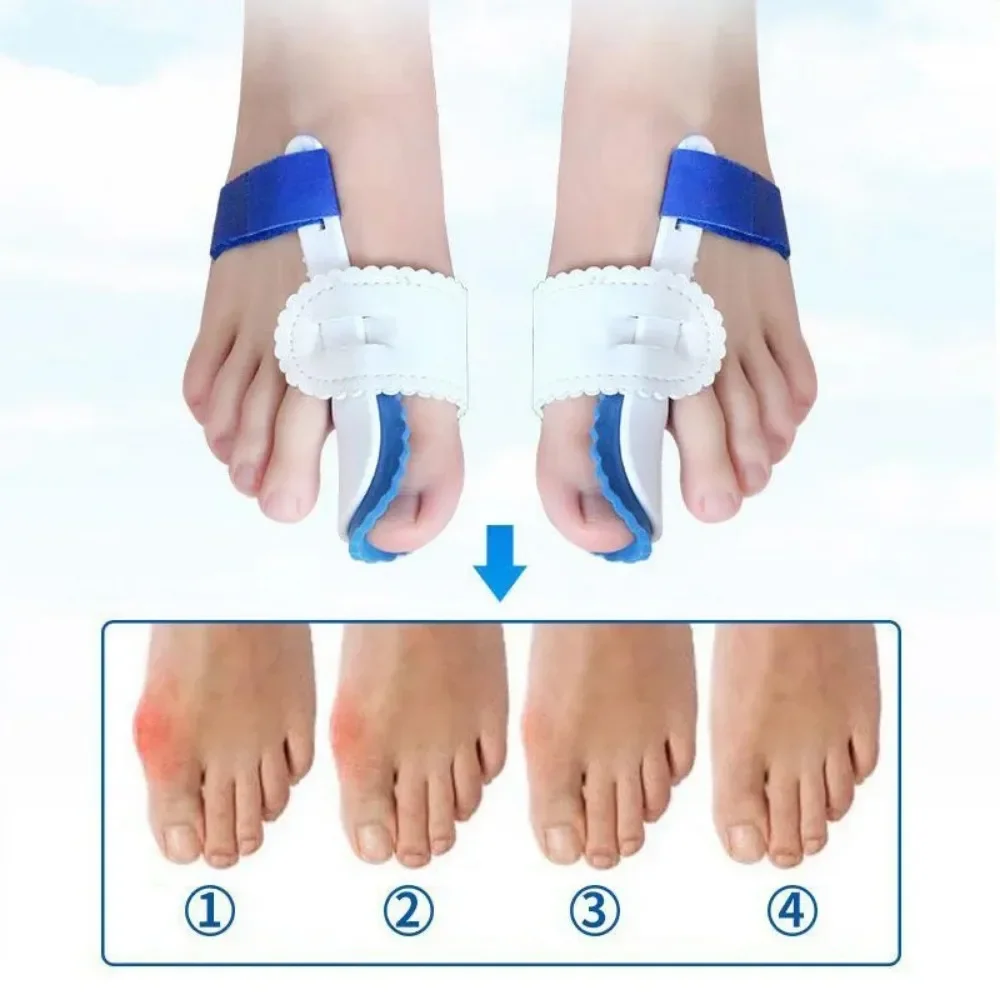 2 pz Halux Valgo Correttore Piede Per Dita Dei Piedi Separatore Haluksy Borsite Alluce Valgo Toe Spreader Separatori Toe Corrector Borsite