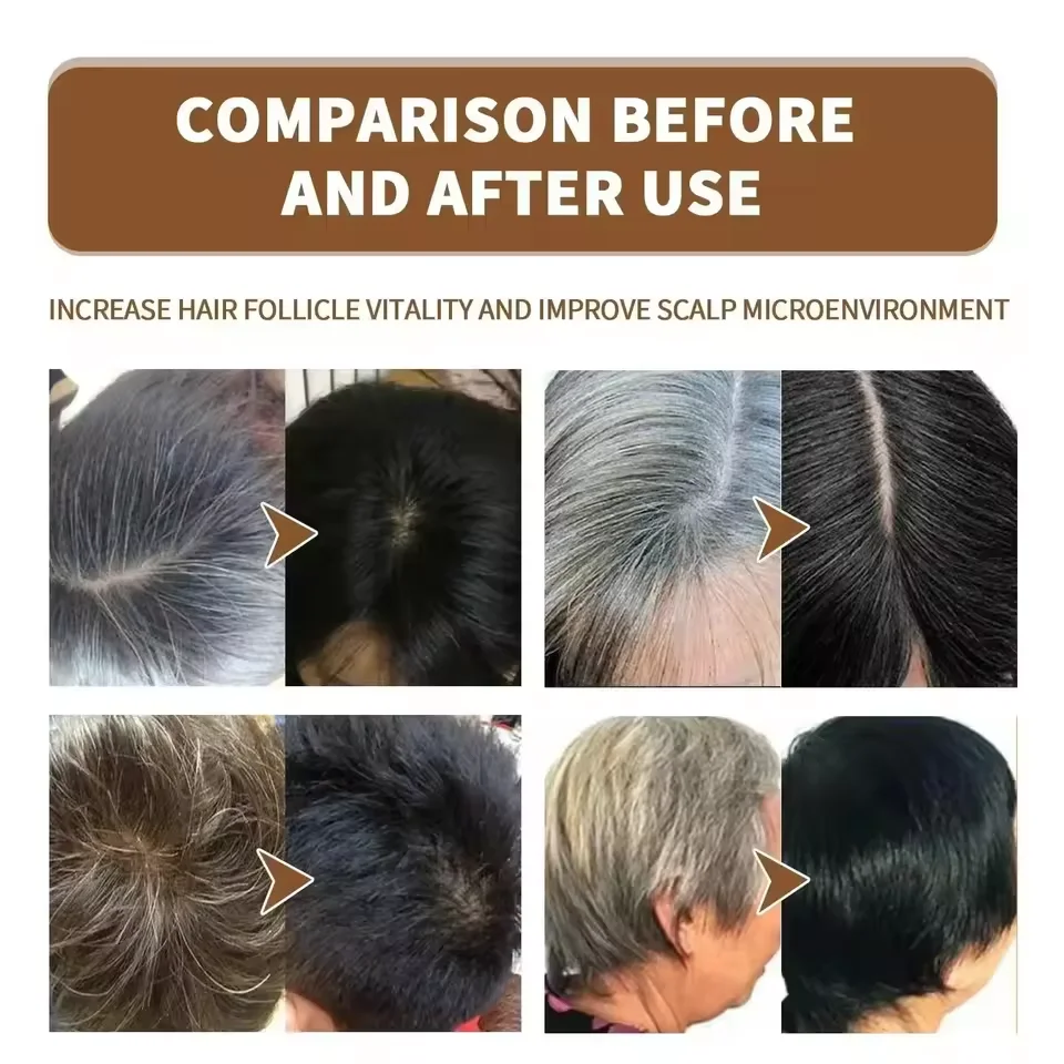 Grijs Wit Haar Behandeling Ser - Hair Care Natural Products recensie en prijs