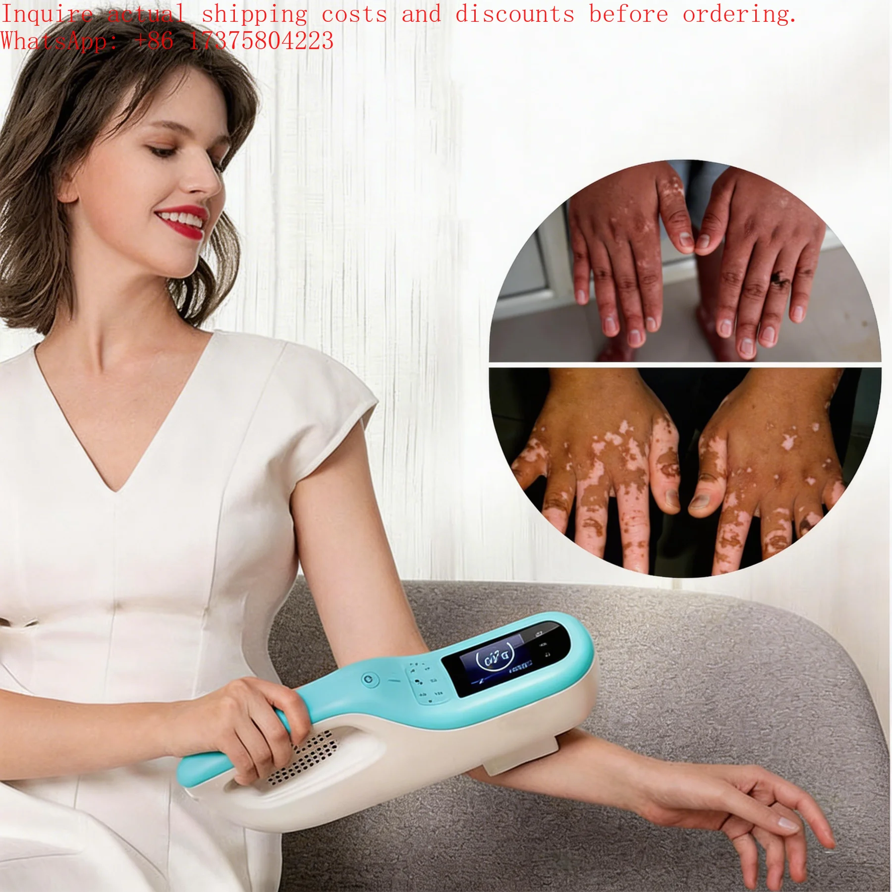 Best-selling Home Use 308nm Excimer Lamp Higher Intensity Clinical Standard 40mW/cm2 Targeted Treatment for Vitiligo
