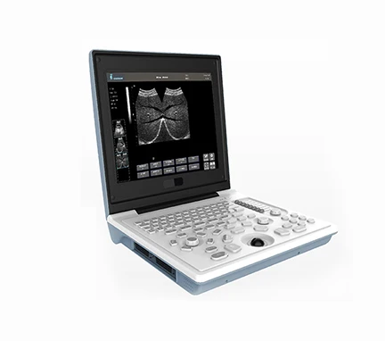 laptop type  black white ultrasound scanner with good price