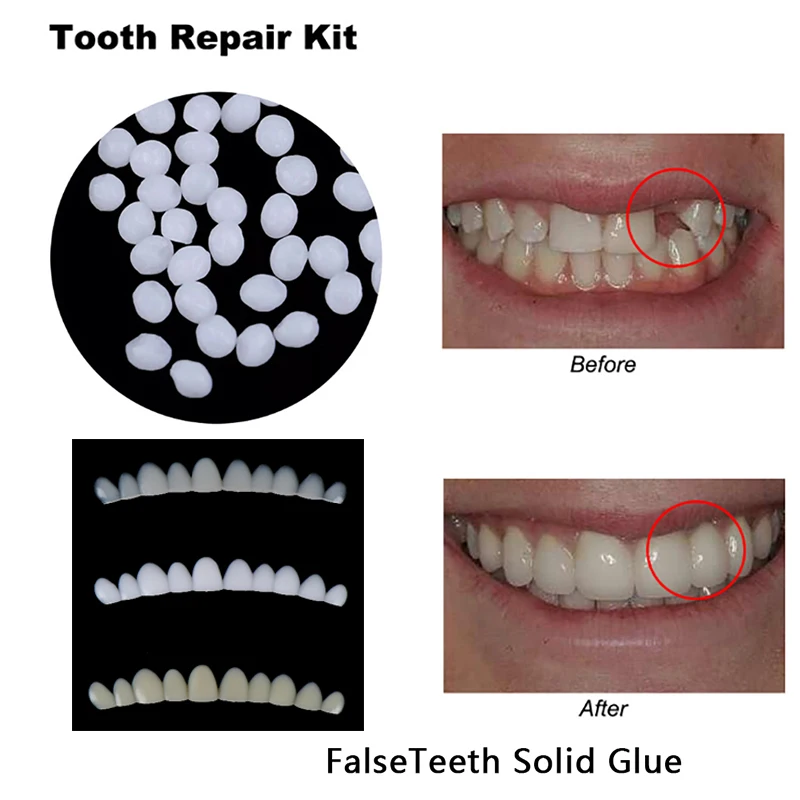 Temporary Tooth Repair Kit Teeth Gaps Falseteeth Solid Glue Denture Adhesive