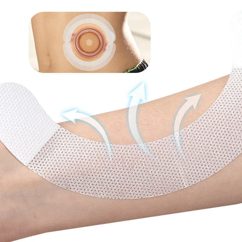 10pcs Stoma Bag Water-needle Bonded Reinforced Adhesive Stoma Baseplate Fitting Reinforcement Strip Leakage-proof Stoma Care Set