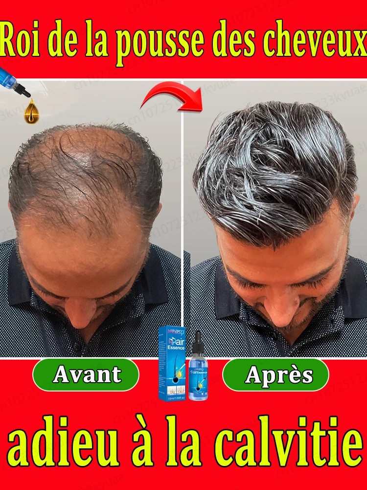 Hair loss savior. Repair hairline. Say goodbye to baldness and hair loss