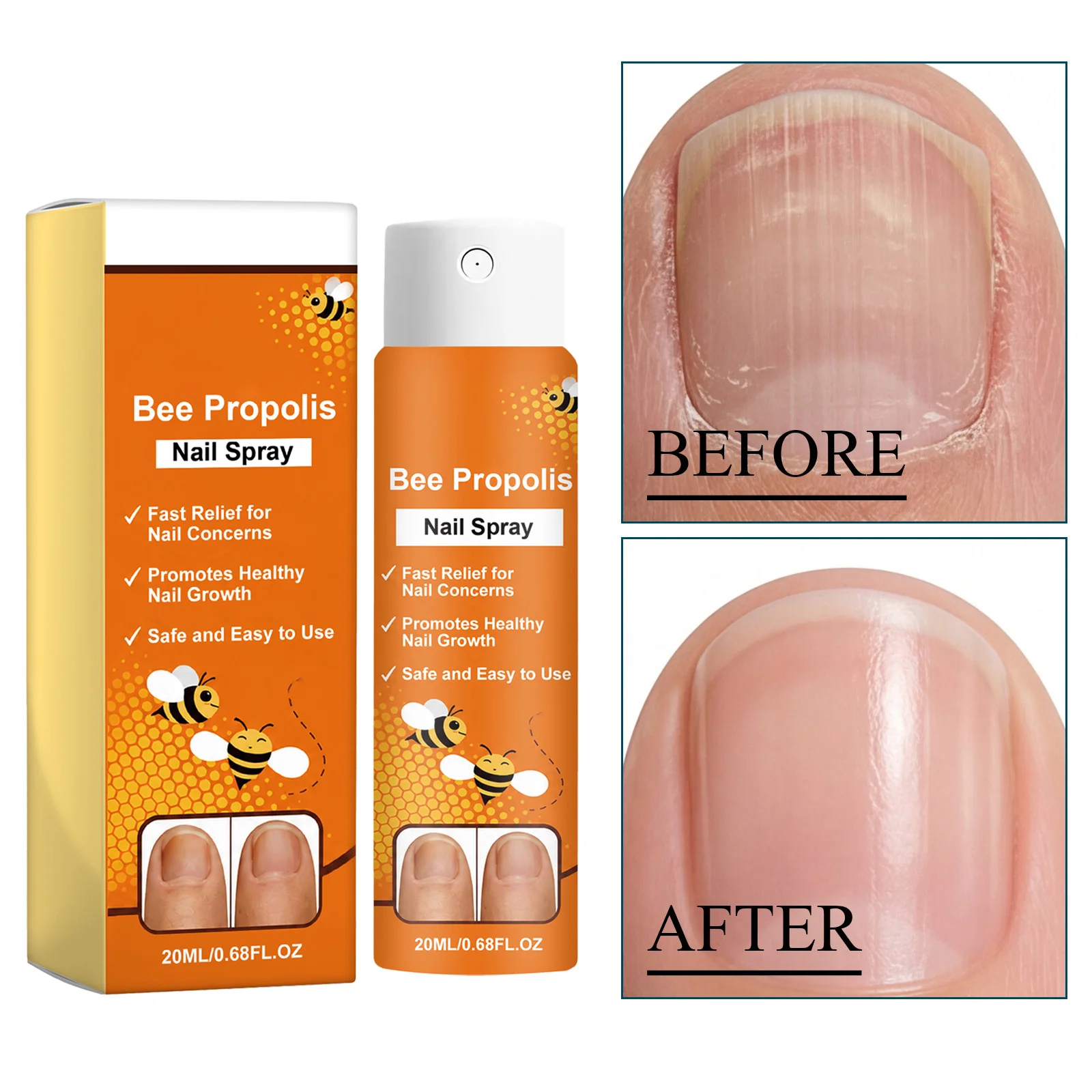 Bee Venom Nail Soothing Spray Nail Repair Treatment for Damaged&Discolored Toenail Moisturizing Nourishing Care for Brittle Nail