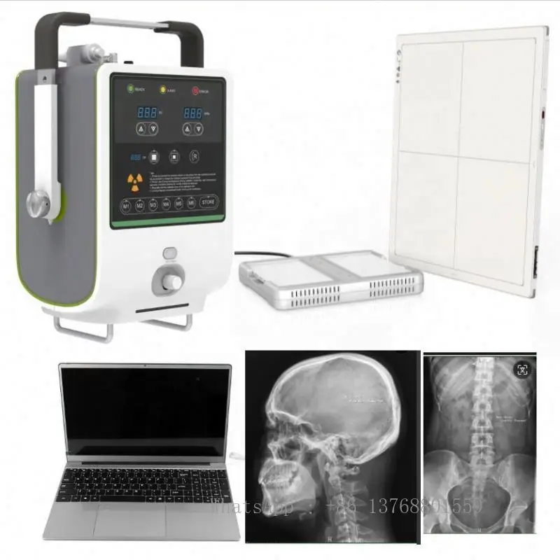 Wireless Exposure X-ray Machine Portable X Iray DR System