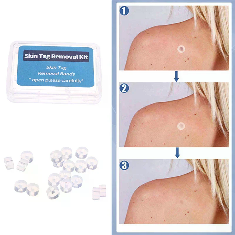 20pcs Care Tools Skin Tag Removal Rubber Bands Micro Band Non Toxic Face Care Mole Wart Skin
