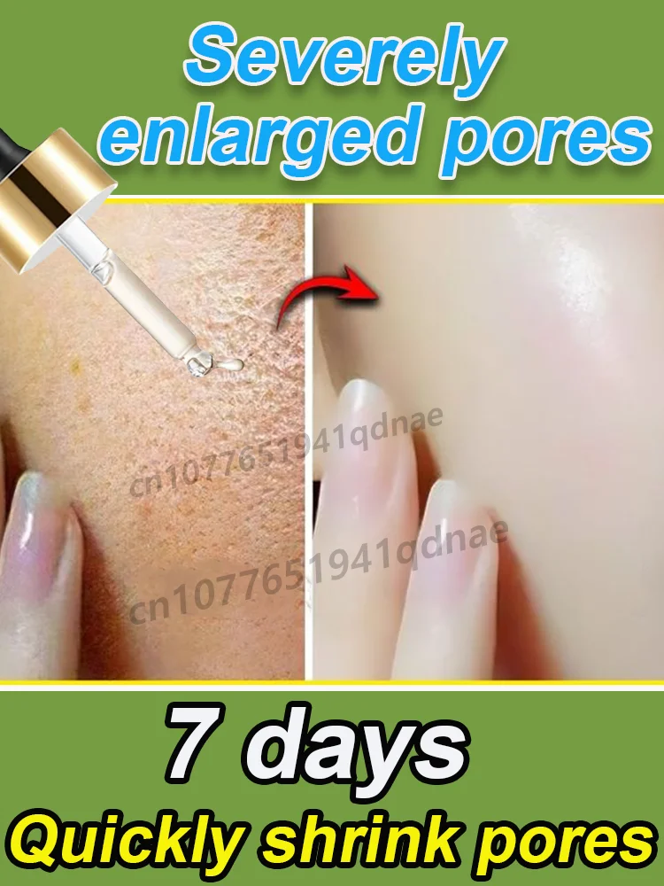 Pure plant extracts reduce oil secretion