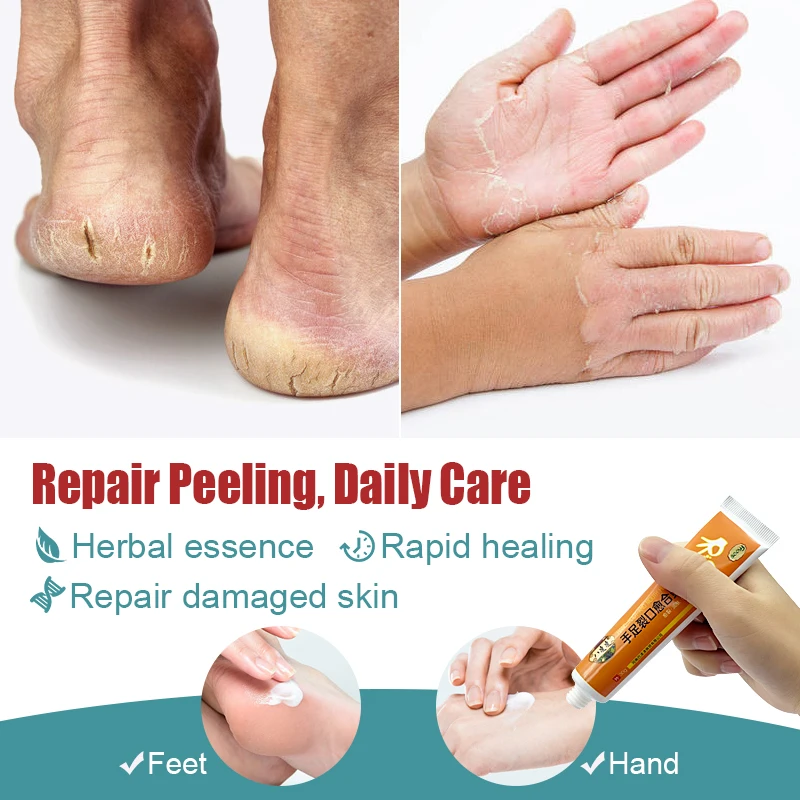 1pcs Foot Chap Treatment Cream Repair Hand Heel Chap Moisturizing Cream Frostbite Reduce Wrinkle Skin Dry Itch Skin Care S012