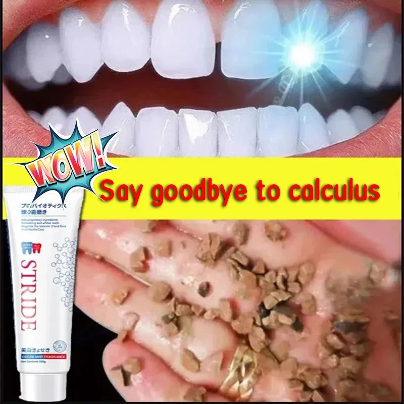 

Dental Calculus Remover Toothpaste Preventing Periodontitis Removal Bad Breath Remove Yellow Teeth Cleansing Care Toothpaste