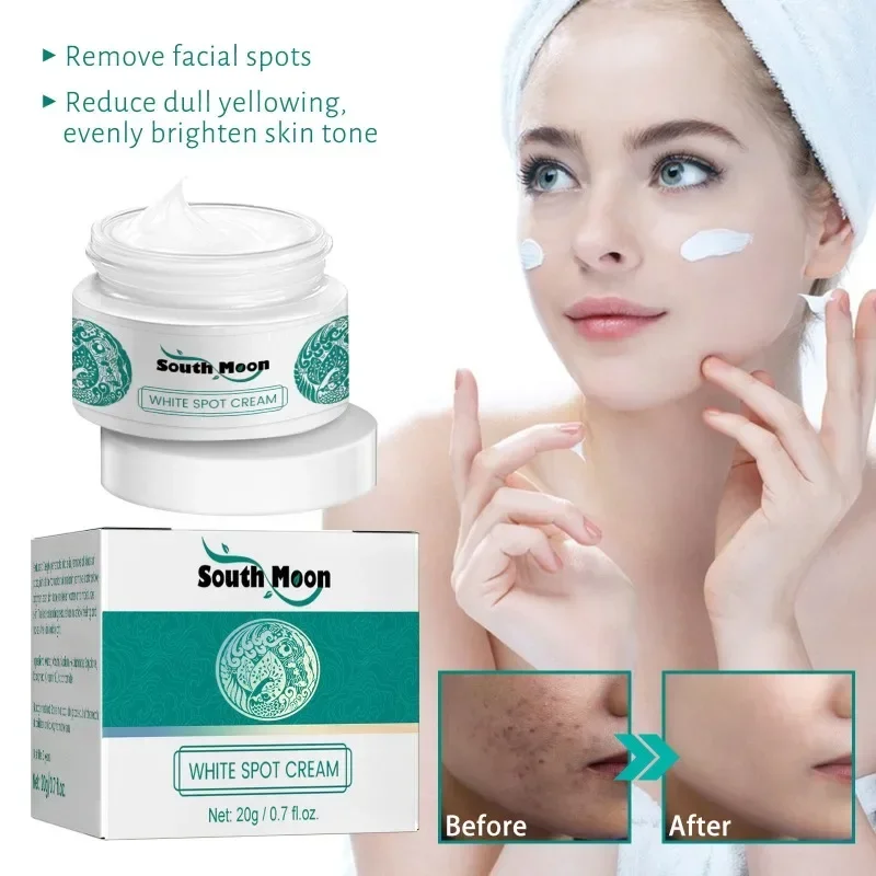 Effective Remove Spot Whitening Face Cream Fade Dark Spot fine lines firming Skin care Freckle  Moisturize Brighten Beauty Care