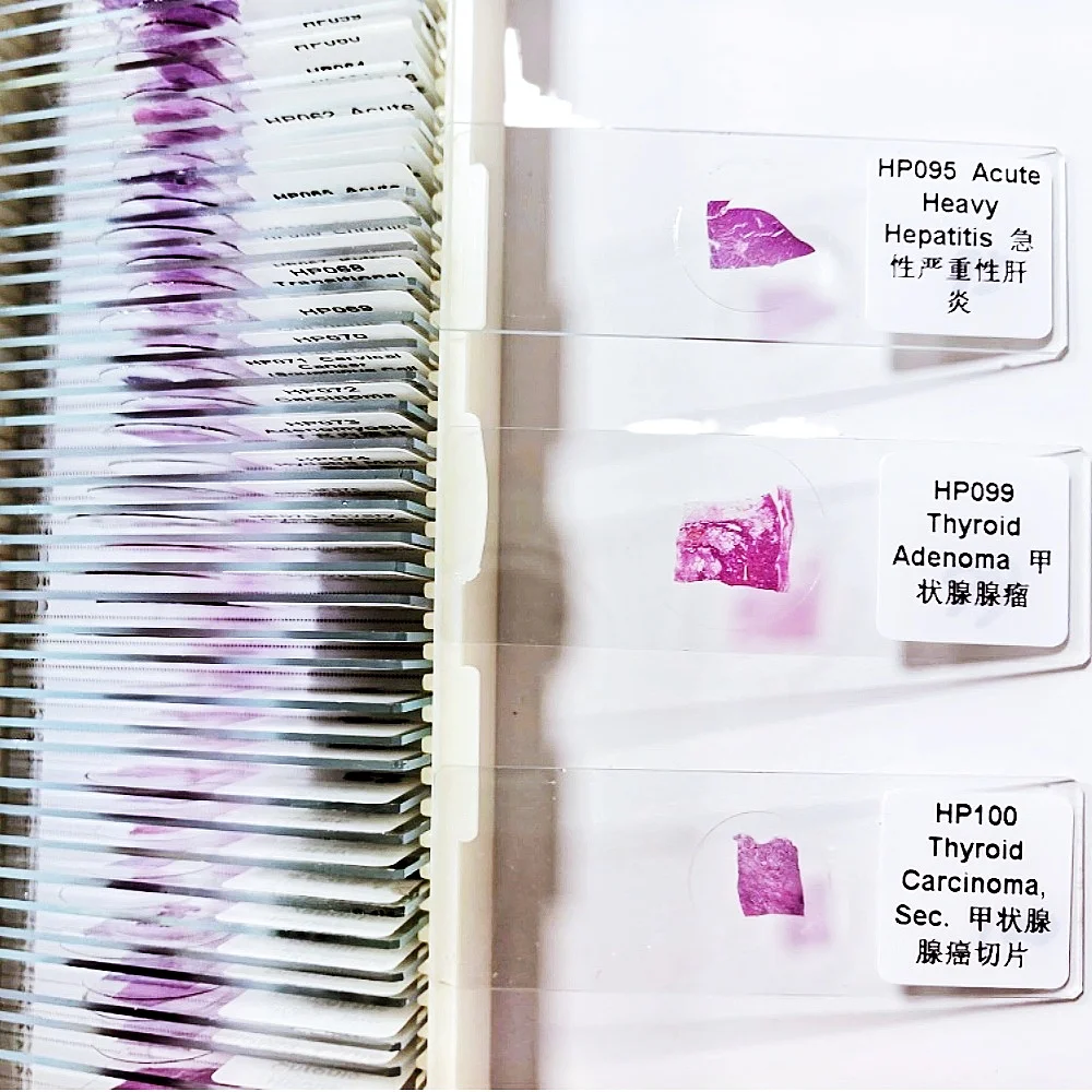 

100Pcs Medical Human Pathology Set Pathological Prepared Slides