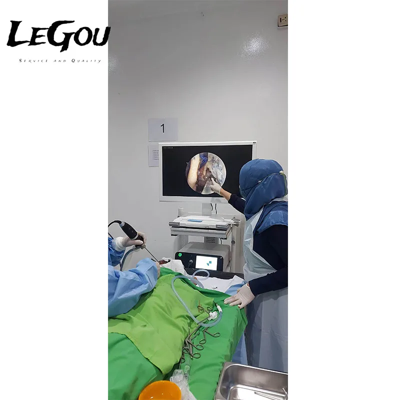 LeGou Professional Medical Portable FHD 1200P Ent Endoscope Camera for GYN Urology Bipolar