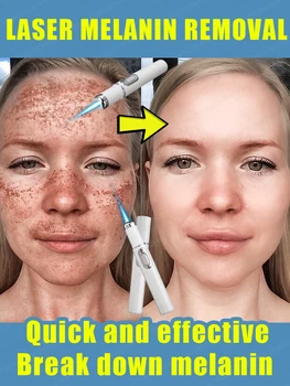 จุดด่างดำบนใบหน้าหายไป