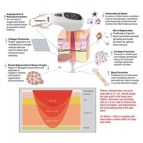 Imagen 2 del producto Dispositivo de terapia con láser frío de 2x808nm para aliviar el dolor corporal, gafas sin bolsa, equipo de fototerapia para artritis, codo de tenis, mascota