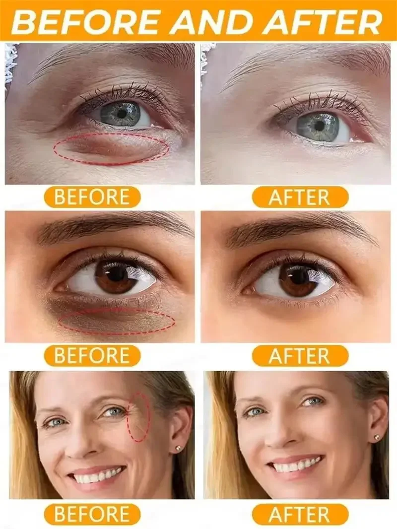 Collagen Instant Eye Bag Removal Cream Removal Wrinkles Lifting Fade Fine Lines Moisturizing Brightening Anti Puffiness Eye Care