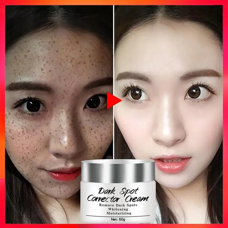 Newest Dark Spots Corrector Cream Whitening Facial Cream Repair Fade Freckles Remove Dark Spots Melanin