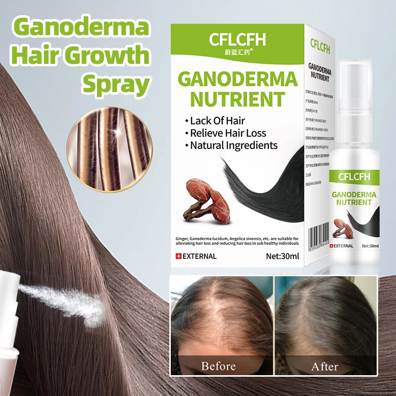 

Hair Growth Spray Ganoderma Lucidum Ginger Liquid Anti Hair Loss Treatment Scalp Hair Care Fast Regrowth Products for Men Women