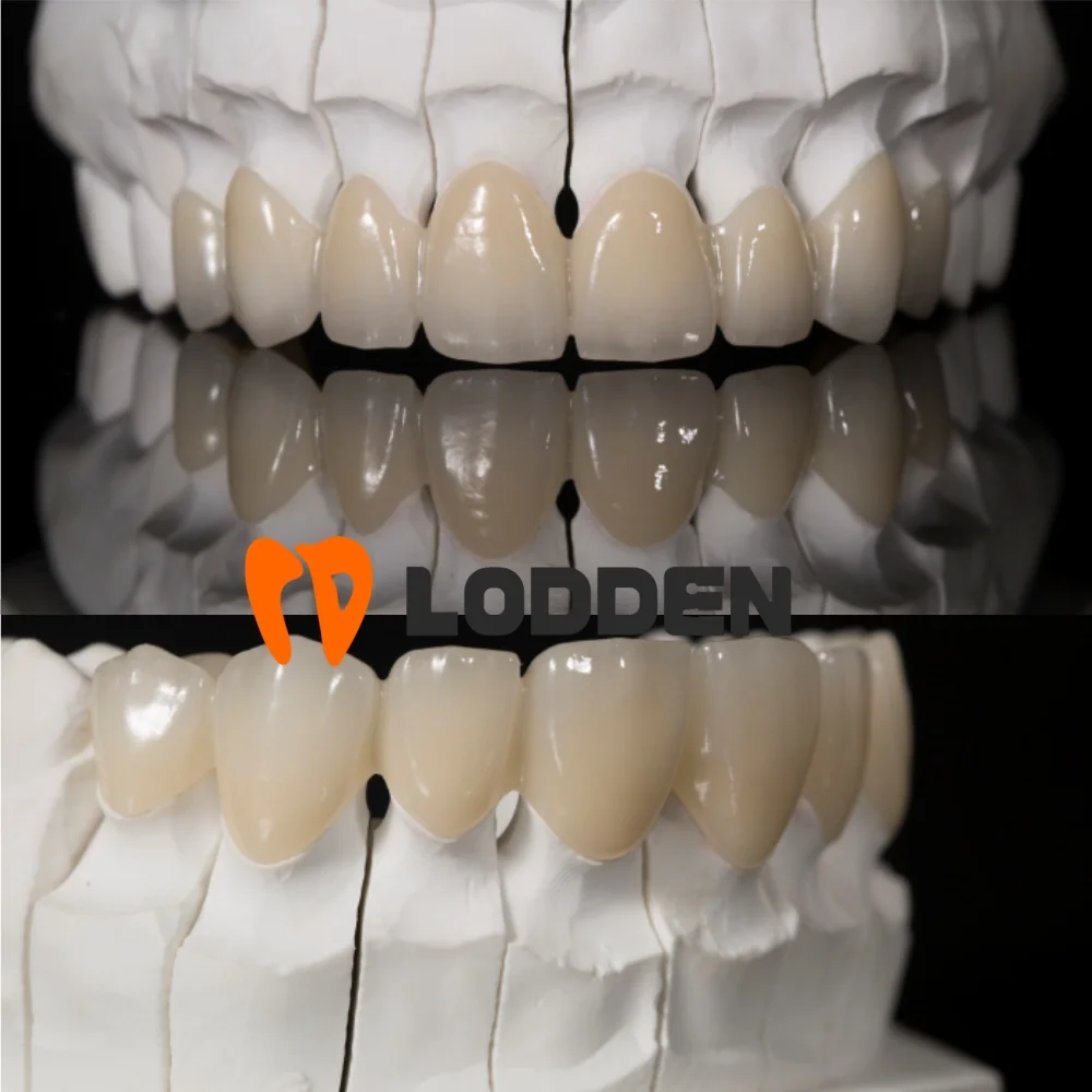 Lodden Dental Zirconia Block 4D PRO متعدد الطبقات لمواد مختبر CAD CAM نظام مفتوح 43%-57% قوة 700-1200Mpa Sinocera