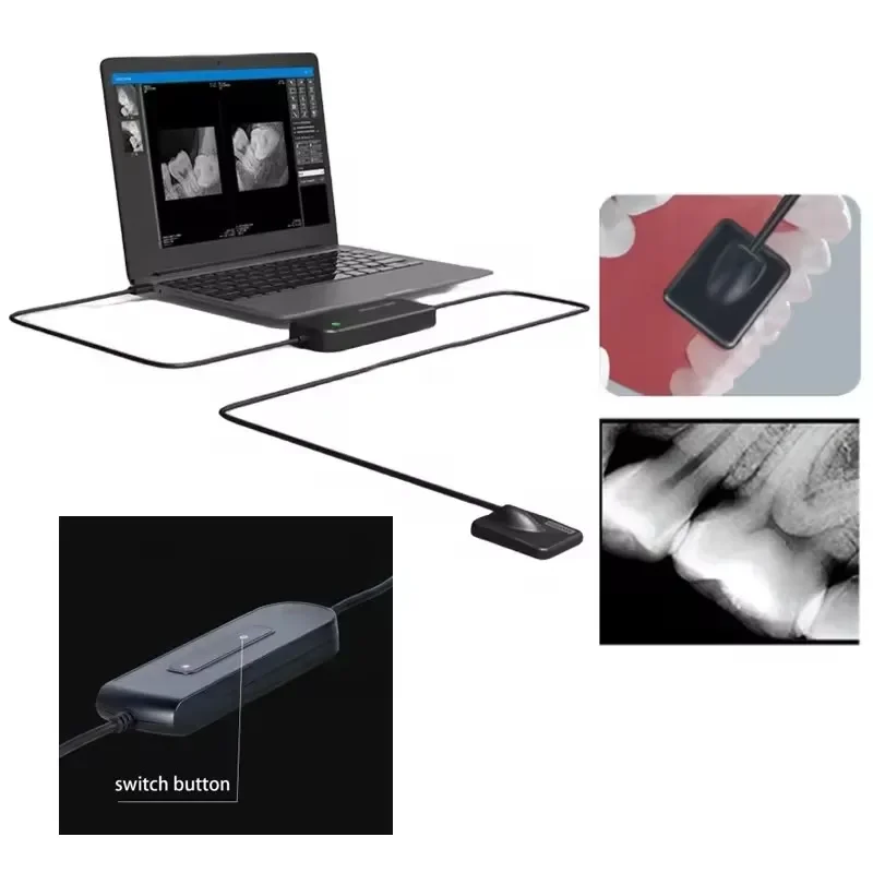 Perlengkapan dokter gigi Sensor sinar X frekuensi tinggi sistem Digital Intraoral Rx alat full-Ray gambar H D