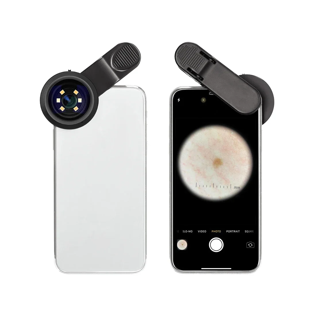 Medical Microscope Polarized LED Light Illumination Dermatoscope, Digital Dermoscope for Dermatology