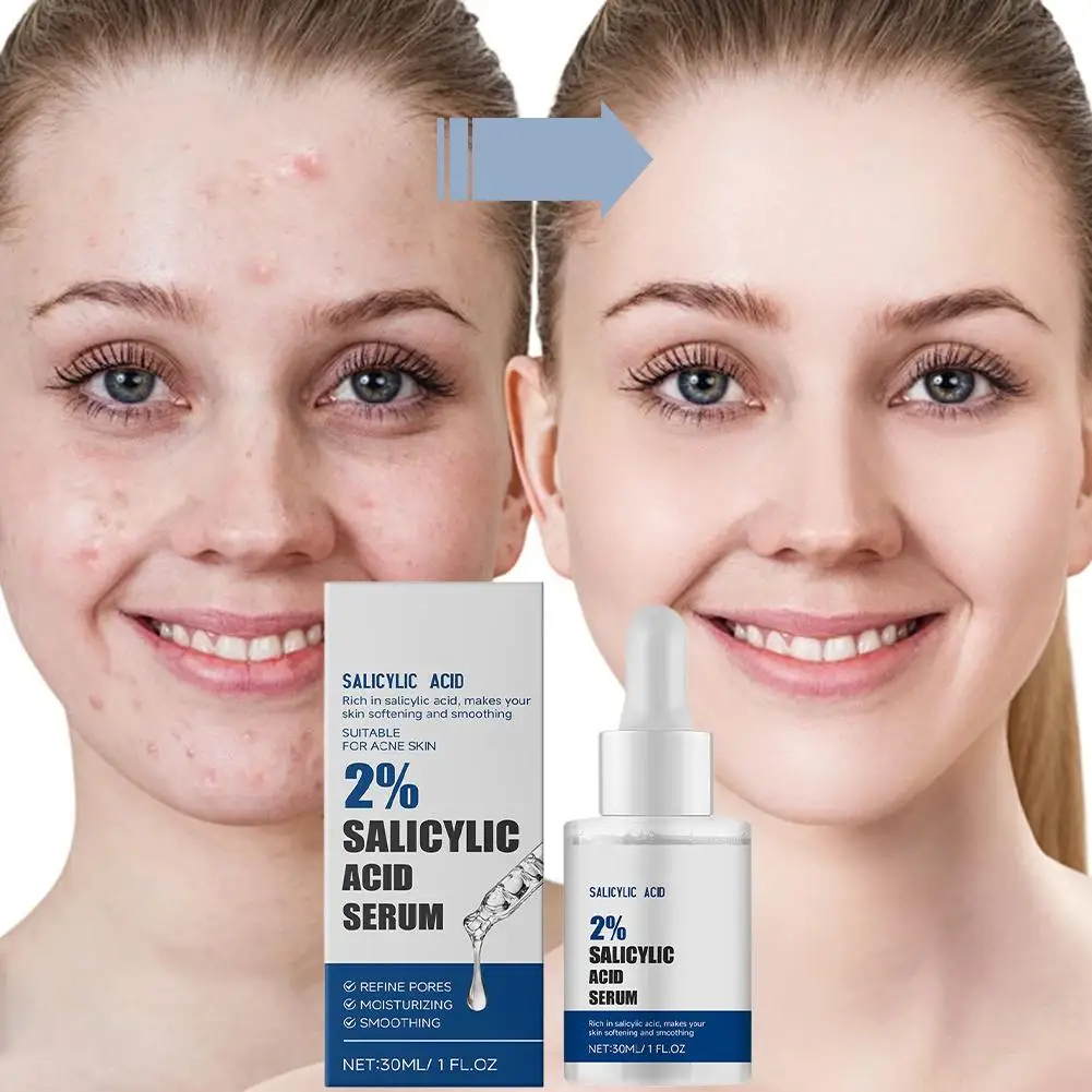 2% 살리실산 세럼은 섬세한 모공을 조여줍니다. 페이셜 에센스 하이드레이팅 젠틀 수축 모공 여드름 제거 세럼 페이스 스킨 케어